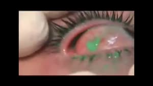 Eyeball Tattoo