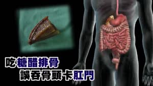 Man gets spare rib stuck in anus