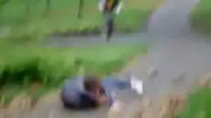 Faceplant on a razor scooter