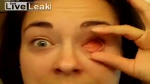 This Is What A Prosthetic Eye Looks Like
