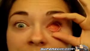 Girl Removes Prosthetic Eye