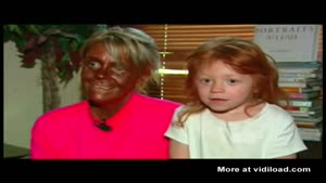 Insane Mother Tanning 6yo Daughter