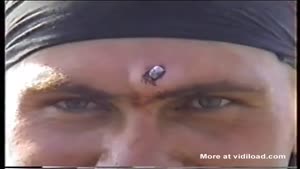 Soldier Has Bullet In Forehead
