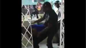 Man Loses Leg While Dancing