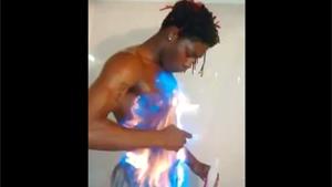 Moron Lights Himself On Fire