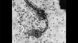 White Blood Cells Attack Parasite