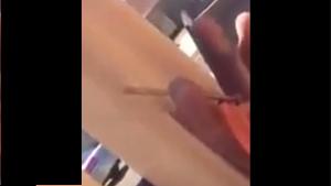 Removing Nail From Finger