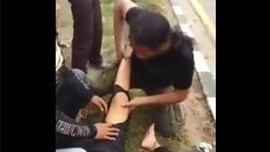 Fixing Dislocated Ankle