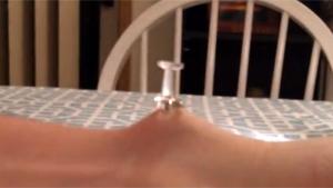 Popping Cyst With Thumbtack