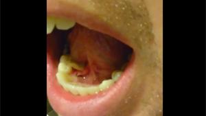 Shitting With His Tongue