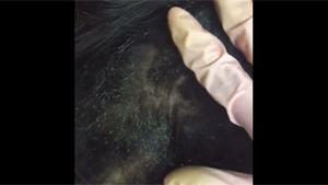 Itchy Head
