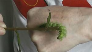 Venomous Caterpillar Bite