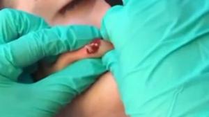Something Extremely Gross